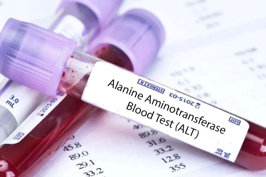 Alanine Transaminase (ALT): Potential Sources of Error in your Lab Result